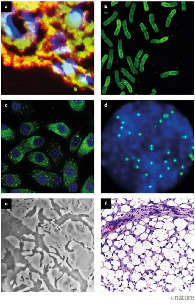 Imagens geradas por Inteligência Artificial ameaçam a ciência - Olhar Digital - Imagem adicional